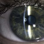 Close-up on a human eye