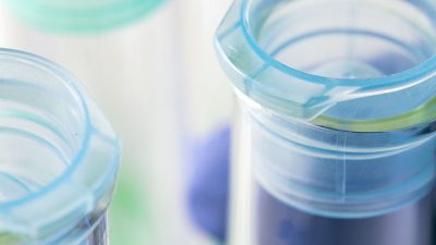 A close up of someone with a medical grade purple glove handling glass test tubes in fluorescent lab lighting