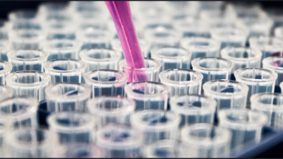 Photo of test tubes arranged in parallel